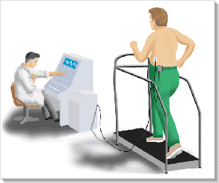 Terheléses EKG