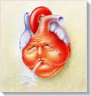 Szív- érrendszeri betegségek, Szívelégtelenség