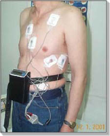 Holter EKG