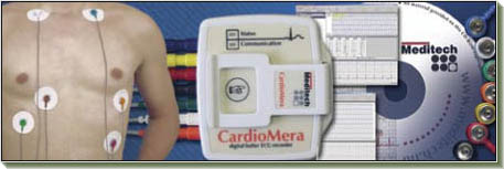 CardioMera Holter készülék